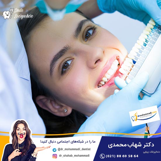 فیلم اصلاح طرح لبخند با کامپوزیت - کلینیک دندانپزشکی دکتر شهاب محمدی